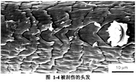 头发总分叉是缺什么营养,头发不分叉是不是营养好
