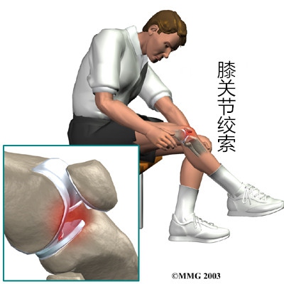 长期运动造成膝盖疼痛怎么恢复,修复膝盖关节最好的运动