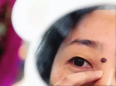 华山医院整形外科点痣,八大处整形外科哪个医生点痣好