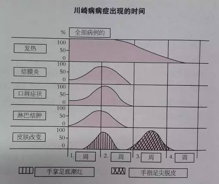 六大症状确诊川崎病,治疗还有什么好招?