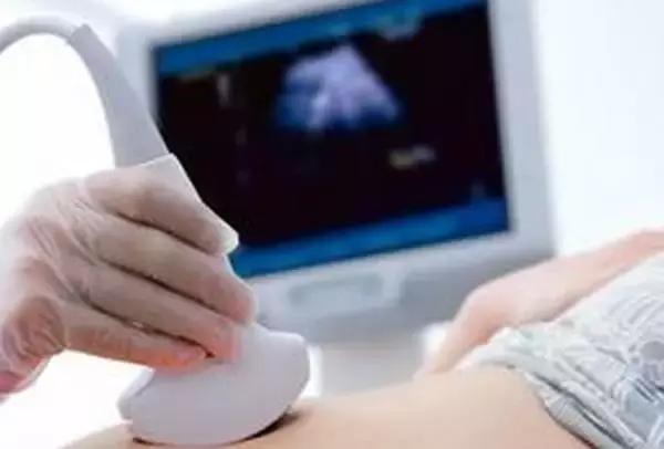 孕期b超对胎儿辐射有影响吗,b超有辐射吗多长时间可以做一次