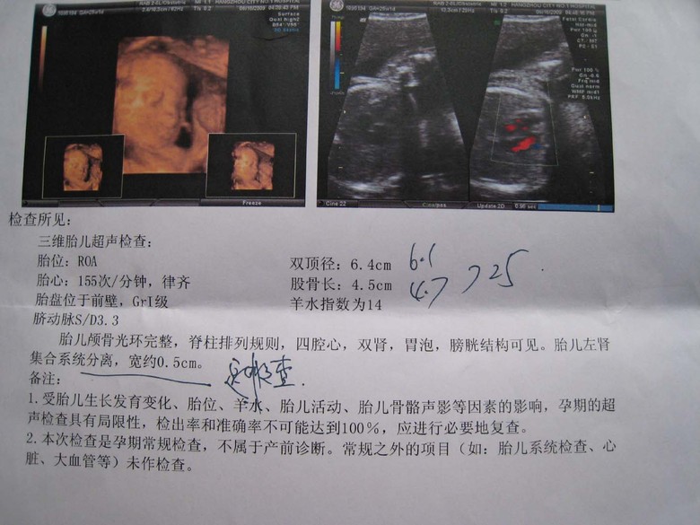 孕妈妈怀孕后，每次去医院做超声波检测时医生到底看什么