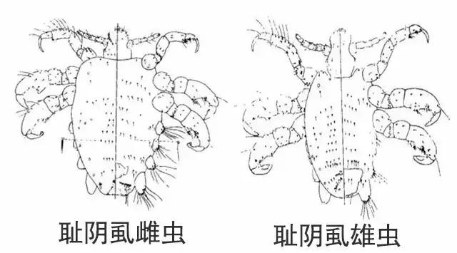 不可言说丨*处私**掉毛发痒，出现这些异常比秃头还严重！