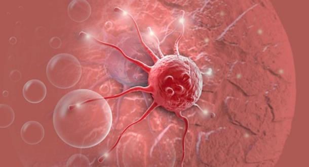 腺癌与鳞癌哪一个发病率高,为什么鳞癌多为中央型肺癌