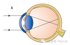 生活方式决定了健康状况,怀孕期间眼睛会出现什么情况
