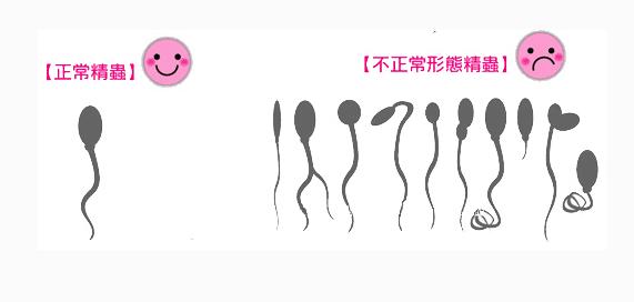 弱精症怀孕的最佳方法,弱精症畸精症有可能怀孕吗