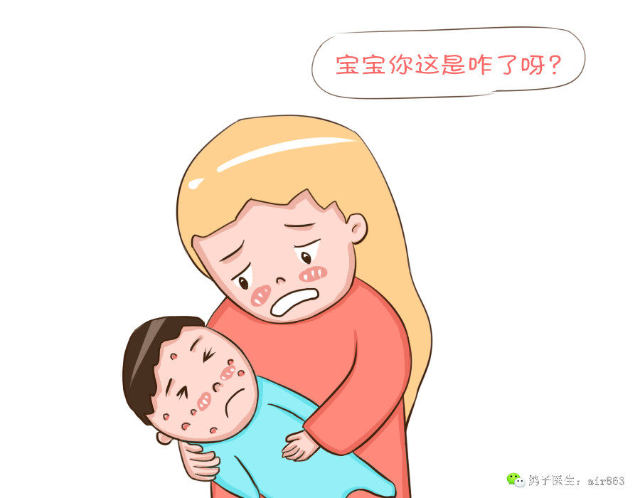 宝宝出水痘?不用怕,妈妈可以这样做!