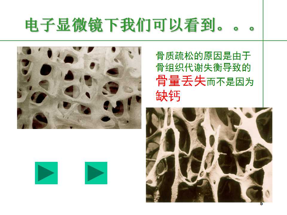 人到中年后骨质疏松要怎么治,中老年人骨质疏松该怎么办