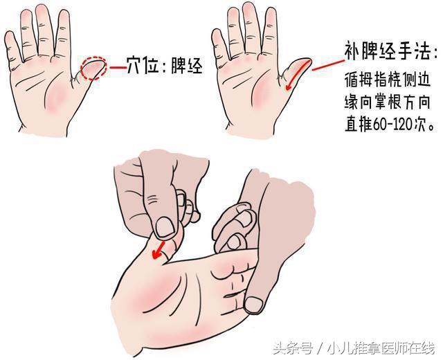 水痘的小儿推拿手法,吴老师推拿视频