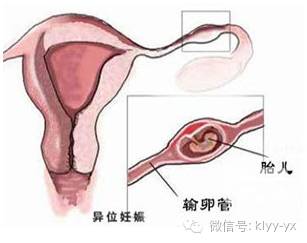 孕期分泌物为啥会变多,孕期各个阶段分泌物情况