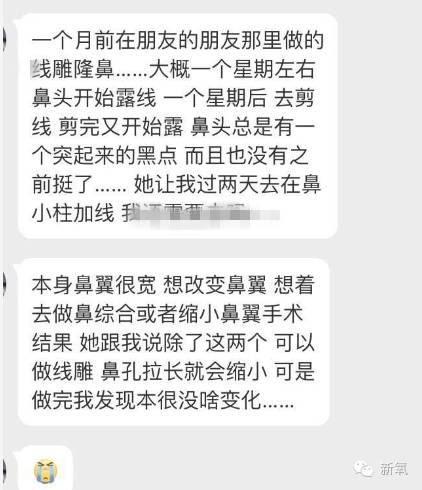 林允是不是整鼻子了,林允隆鼻过吗