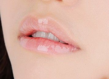 嘴唇干裂脱皮怎么办有什么方法,嘴唇干裂脱皮怎么办最有效
