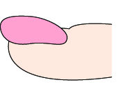 指甲竖纹里面有白点是什么原因,指甲有竖纹和白点是怎么回事