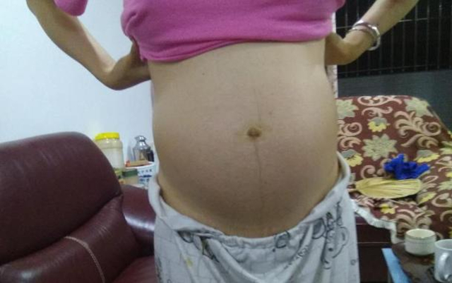 妇产科医生生孩子检查肚子,妇产科医生怀孕了要生了