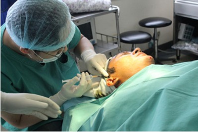 为什么玻尿酸丰唇没有任何效果,玻尿酸丰太阳穴有点压在眼皮