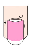 指甲出现白点、纵纹是怎么回事?