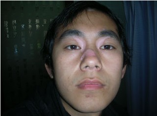 昆明看白癜风医院复美咨询,昆明复美白癜风研究所