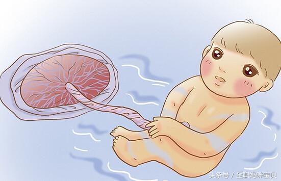 脐带绕颈不要慌,脐带绕颈准妈妈羊水少怎么办