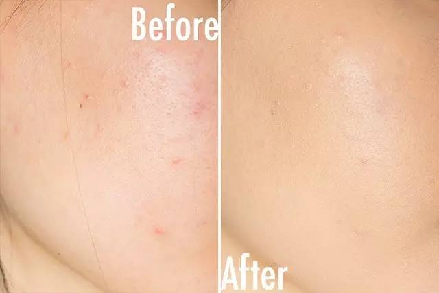 干皮秋冬最好用的24小时粉底液,怎么选择一款适合混干皮的粉底液