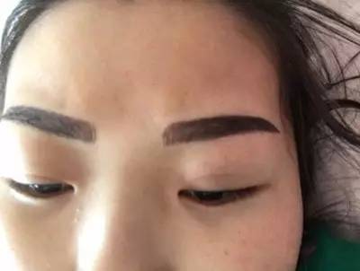 瞒着家人做了美瞳线,做美瞳线为什么会引起角膜炎