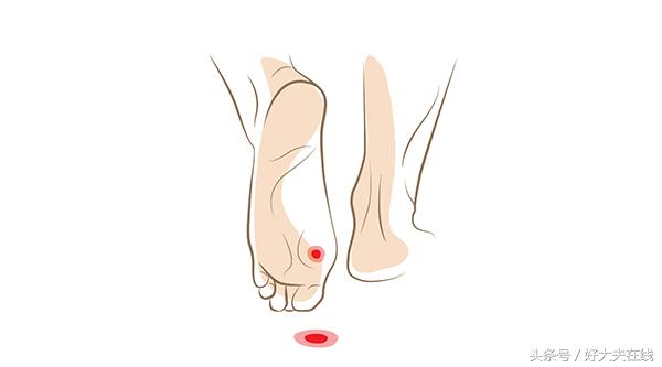 有的鞋走路脚后跟痛怎么回事,走一走就脚痛是鞋的原因吗