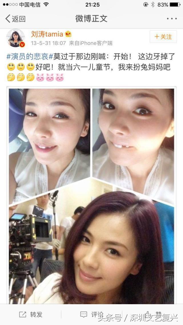 林允整牙效果怎么样,林允整牙后变化图片