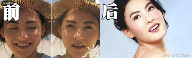 林允整牙效果怎么样,林允整牙后变化图片