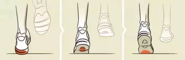 选择跑鞋内翻足和外翻足区别,选鞋不当危害