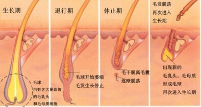 激光脱毛多久后可以正常洗澡,激光脱毛后可以洗澡吗