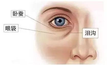 泪沟深怎么办,有了泪沟怎么补救