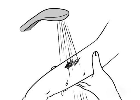 医院有蟑螂如何处理,被蟑螂咬了怎么办要不要去医院