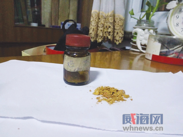 又现“鸡宝”!7旬老人“宝贝”珍藏40多年