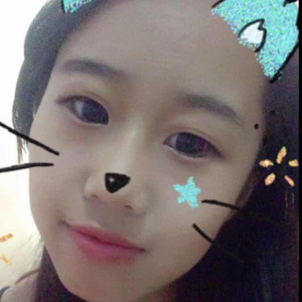 双眼皮手术第五天碰到水怎么办,双眼皮手术前感冒了怎么办