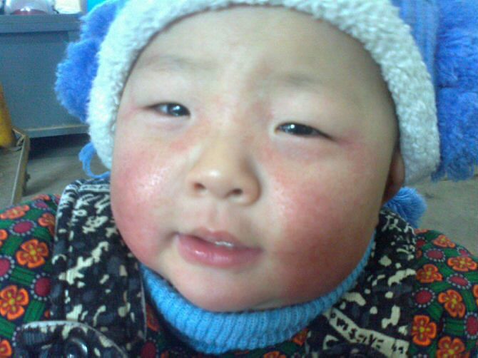 秋冬季节如何保护宝宝的皮肤,儿童冬天怎么保护皮肤