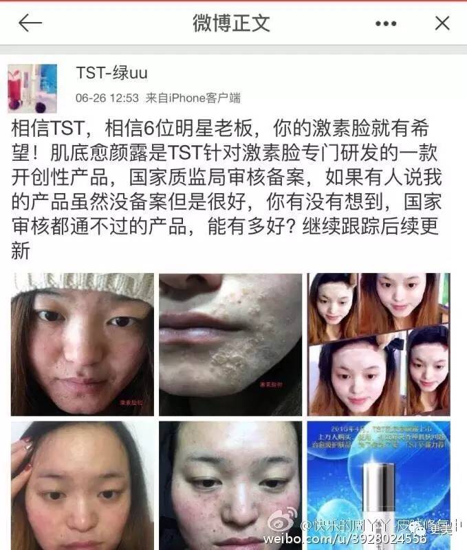 明星卖黑心面膜赚28亿,明星卖面膜