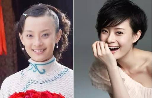 哪些女星整过发际线,发际线最惊人的女星