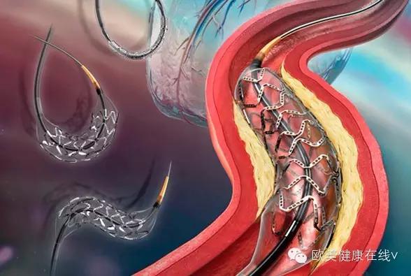 怎样才能到世界顶级医院看病,如何不花钱找专业人士