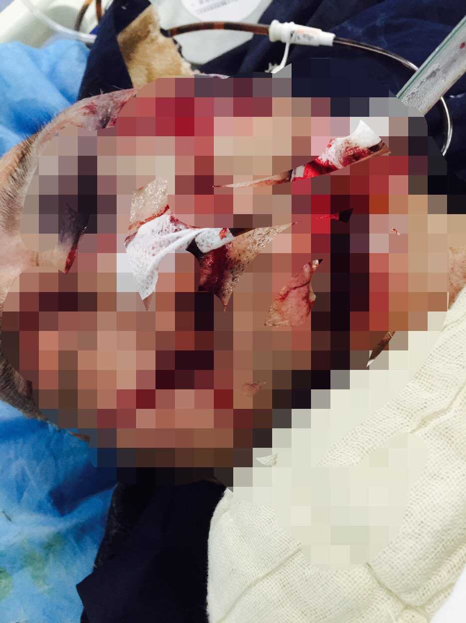 解放军306医院除夕之夜倒计时与正计时