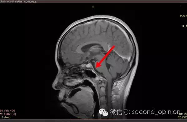中国的质子中心有几家,全国有几所质子医院哪所最好