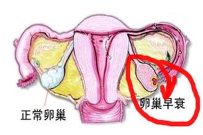 正常卵巢和不健康的卵巢对比,卵巢是否衰老要检查什么