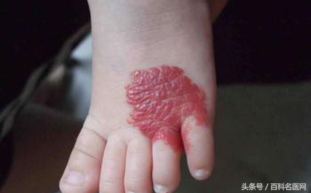 恶性肿瘤身上有很多包是咋回事,身上长个包是恶性的是什么意思