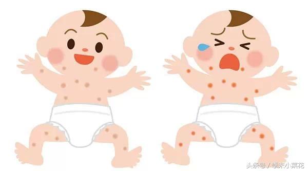 做好这几点有效避免婴幼儿湿疹,孩子湿疹做好这5点