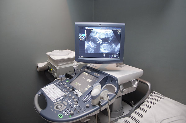 我们如何从B超单看生男生女?最后我相信了