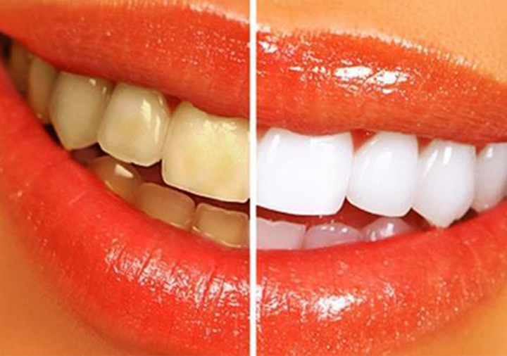 春节前后嘴忙牙累,您的牙齿还好吗?