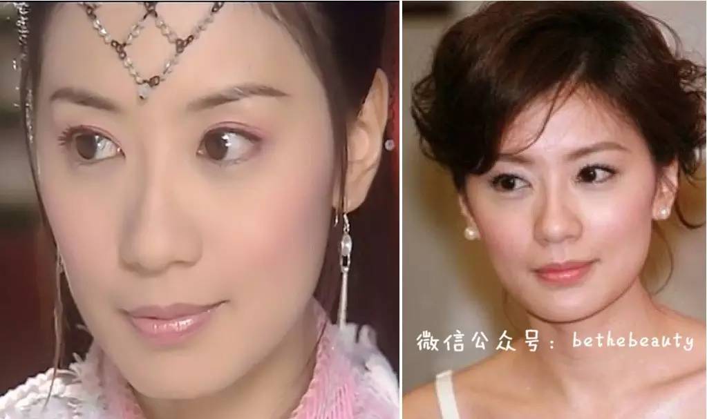 鼻子除了整容变挺还有什么办法,不想整容怎么让鼻子好看