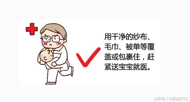 面对宝宝烫伤,亲们千万不慌,谨记宝宝烫伤的最佳处理时间