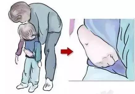 男孩咳嗽一星期被发现白肺,8个月男童反复咳嗽