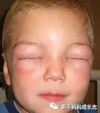 儿童怎么样避免伤害到肾,儿童医院专家教你如何保护孩子