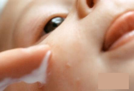 宝宝湿疹了可以擦面霜吗,宝宝湿疹了怎么办