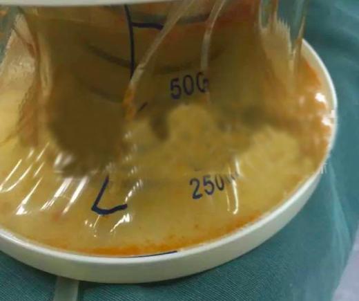 吃泡面不能喝汽水吗,吃泡面为什么不能喝汽水